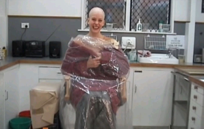 Making prosthetics